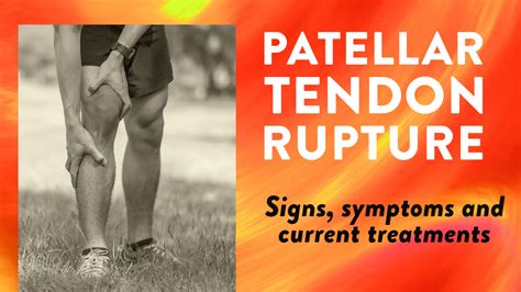 Patellar tendon rupture: Signs, symptoms and current treatments | Dr Geier