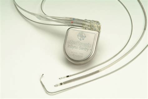 Heart Shocked: Medtronic Pacemaker Defective Leads 268000 at Risk Worldwide 6900 UK - 30% ...
