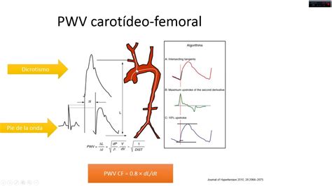 velocidad onda de pulso video presentacion - YouTube
