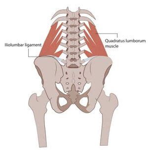 Quadratus Lumborum Syndrome - Physiopedia