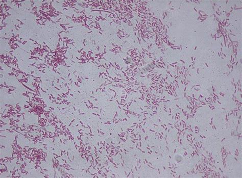 What is Pseudomonas Bacteria? Characteristics, Gram stain & Infection | Pseudomonas aeruginosa ...