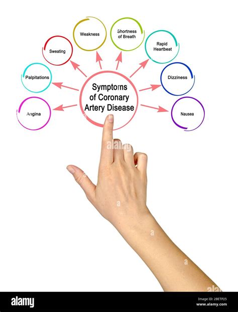 Symptoms of Coronary Artery Disease Stock Photo - Alamy