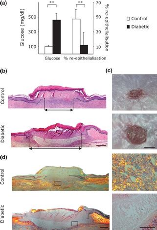 Granulation Tissue Wound Healing Pictures - focistalany