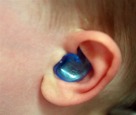 Watch an ear tube surgery and adenoidectomy as it happens #tubes4jordan:Inside Children's Blog