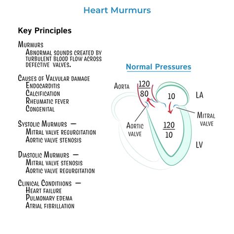 Clinical Pathology Glossary: Heart Murmurs - Stenosis & Regurgitation | ditki medical ...