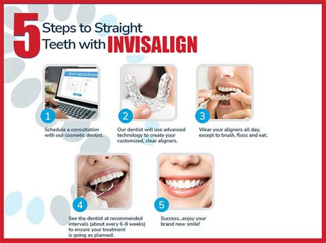 Invisalign Dental Braces: Process and Cost in Ho Chi Minh City - Saigon ...