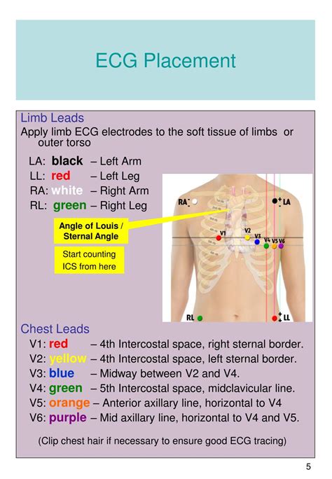 Ecg Placement Guide