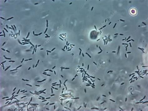 Bacteria from chicken - Stock Video Clip - K003/2807 - Science Photo Library