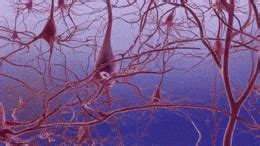 Alzheimer's_disease-neuron_death - Knowing Neurons