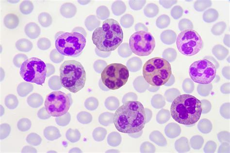 Neutrophil, Basophil, and Eosinophil PMNs