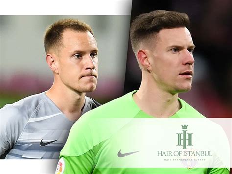 Ter Stegen's New Look: Hair Transplant or Just a Rumor? | Hair of Istanbul