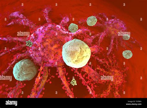 3D rendered Illustration of T-Cells of the immune System attacking growing Cancer cells Stock ...