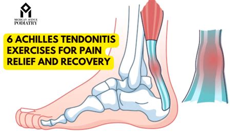 6 Achilles Tendonitis Exercises For Pain Relief And Recovery