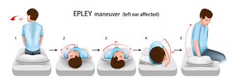 Epley Maneuver Left Ear Affected Vector Illustration Stock Illustration - Download Image Now ...