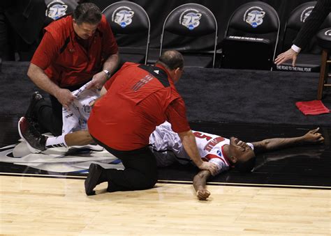 Kevin Ware Leg Injury: See The Gruesome Photo Of Louisville Guard’s Broken Leg [GRAPHIC PHOTOS ...