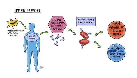 Hämolytische Anämie | MyPathologyReport.ca