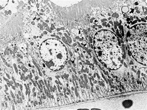 Proximal Convoluted Tubule EM