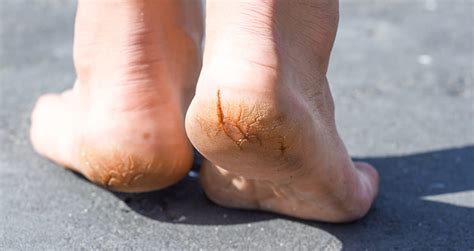 Conditions We Treat - Burbank Podiatrist | Los Angeles Foot & Ankle Center