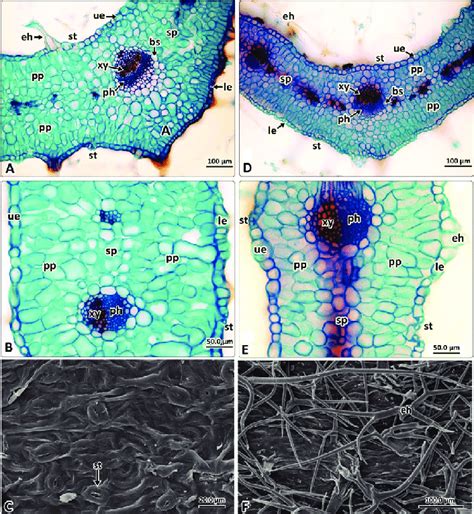 Microphotographs of the leaf cross section under light microscopy (A ...