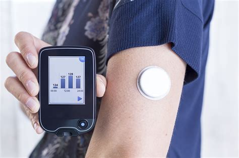 What Is a Continuous Glucose Monitoring Device – and Can It Help Me? | Patient Advice | US News