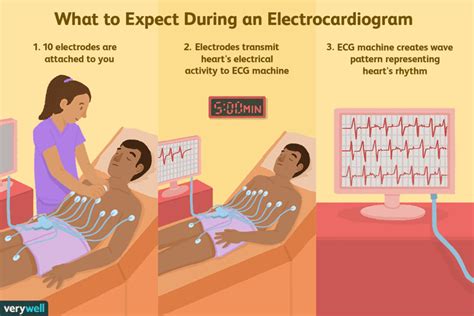 Électrocardiogramme (ECG) : Utilisations, effets secondaires, procédure, résultats