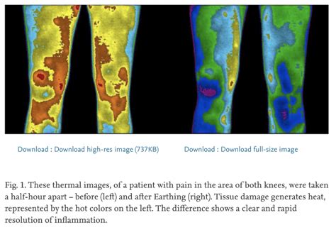 Earthing and Grounding: Science, Benefits, How to - Dr. Robert Kiltz