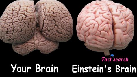 Facts about Albert Einstein brain