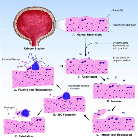 Light Microscopy Findings of Potential IBCs and Filaments in Urines... | Download Scientific Diagram