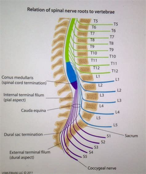 Cauda Equina Syndrome... Occurs due to compression of SPINAL NERVE ...