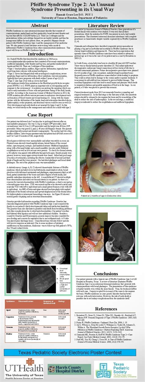 Pfeiffer Syndrome Type 2 An Unusual Syndrome Presenting