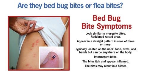 Bed Bug Bite Symptoms - Hilton Head Island, Bluffton and Beaufort - Island Pest Control