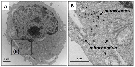 Peroxisome Micrograph