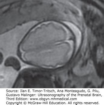 CRANIOFACIAL ANOMALIES | Radiology Key