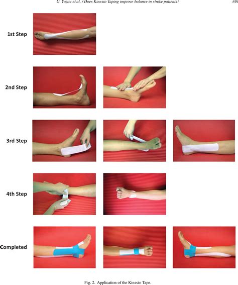 Peroneal Tendonitis Taping