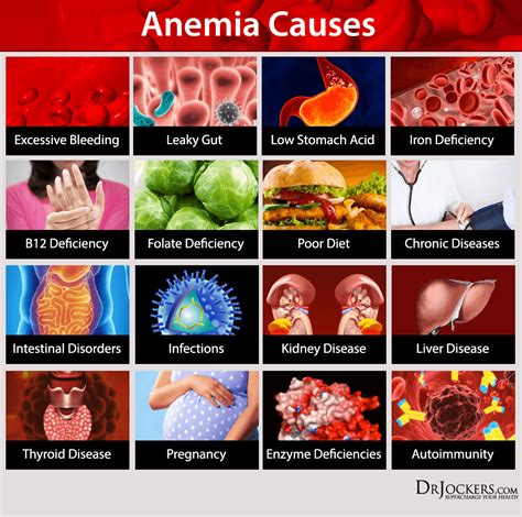 What causes mild anemia: Anemia Information | Mount Sinai