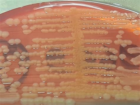 E. coli: Introduction, Identification Features, Keynotes