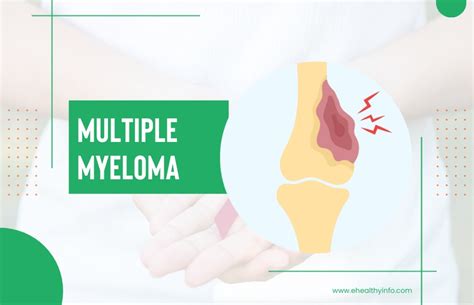 Multiple Myeloma - Diagnosis, Treatments, And Myeloma Cancer Care