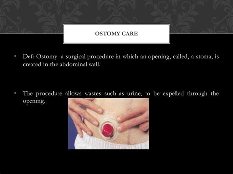 PPT - Providing ostomy care PowerPoint Presentation, free download - ID ...