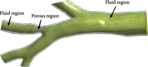 Pulmonary artery stenosis model. | Download Scientific Diagram