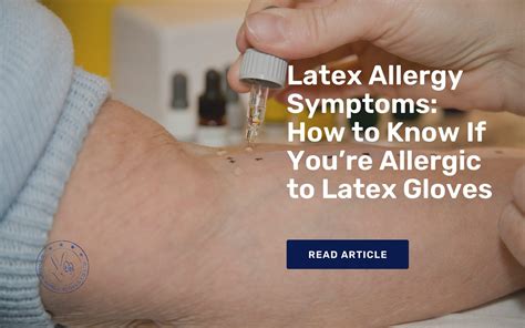 Latex Allergy Symptoms How to Know If You’re Allergic to Latex Gloves-edit | Happy Hands Gloves