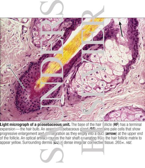 Light Micrograph of a Pilosebaceous Unit