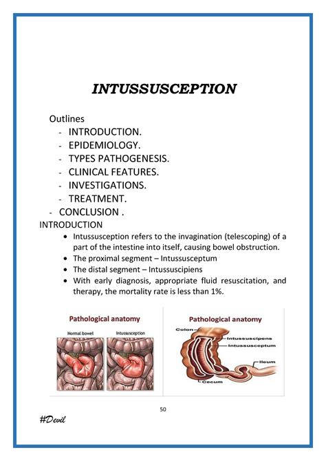 Intussusception - Neonatal Surgery - 50 INTUSSUSCEPTION Outlines - INTRODUCTION. - EPIDEMIOLOGY ...