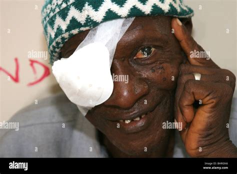 An African man with a bandage over one eye after a cataract operation ...