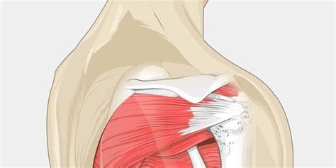 Swimmer’s Shoulder – The Complete Injury Guide - Vive Health