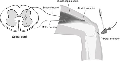 Quadriceps Reflex