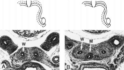 Histology of Mü llerian ducts in control and DES-exposed male mouse... | Download Scientific Diagram