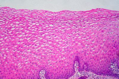 Uterus Histology - Cervix - histology slide