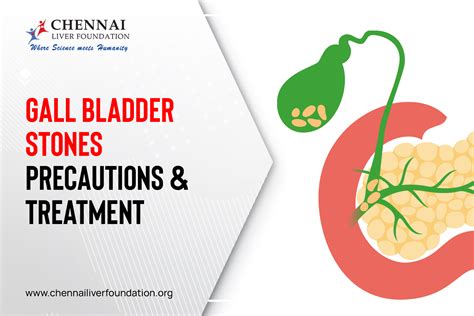 Gall Bladder Stones: Precautions & Treatment - Chennai Liver Foundation