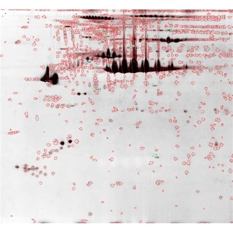 Comparison of two-dimensional (2D) gel electrophoresis results using ...