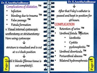 Stricture urethra by Dr.K.AmrithaAnilkumar | PPT